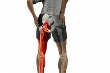 Siyatik Sinir Ağrısı Belirtileri ve Tedavisi