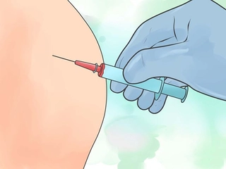 Siyatik İğnesi Kullanımı ve Faydaları Nelerdir?